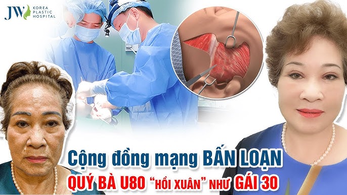 Truyện Ma Hóa Yêu – Phần 16: Hồi Kết Nghiệt Ngã Của Cổ Thuật